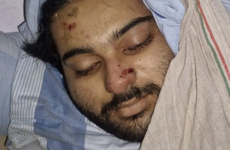 झांसी-कानपुर राष्ट्रीय राजमार्ग पर भीषण हादसा, अतीक अहमद के बेटे अबान अहमद की मौत   पूंछ थाना क्षेत्र में तेज रफ्तार कार दुर्घटनाग्रस्त, दो की मौके पर मौत, तीन युवक गंभीर रूप से घायल